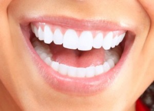 Smile with tooth covered fillings